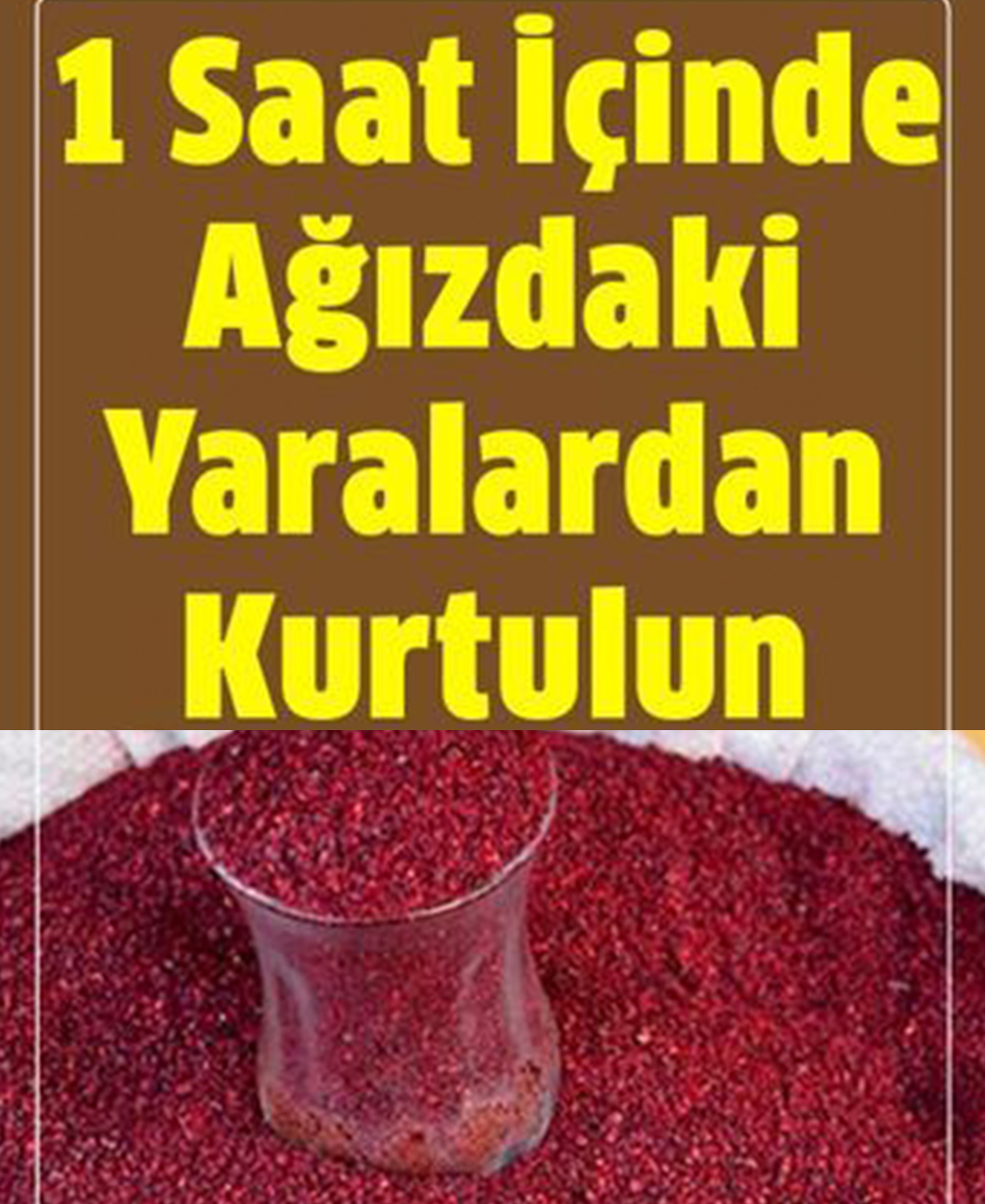 Ağızdaki Yaraları 1 Saat İçinde Yok Ediyor - 1