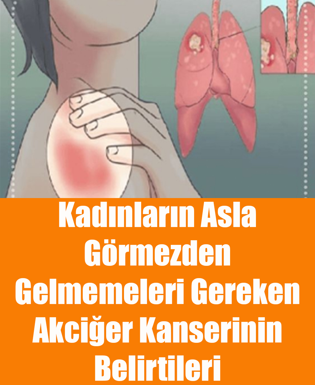 Kadınların Asla Görmezden Gelmemeleri Gereken Akciğer Kanserinin Belirtileri - 1