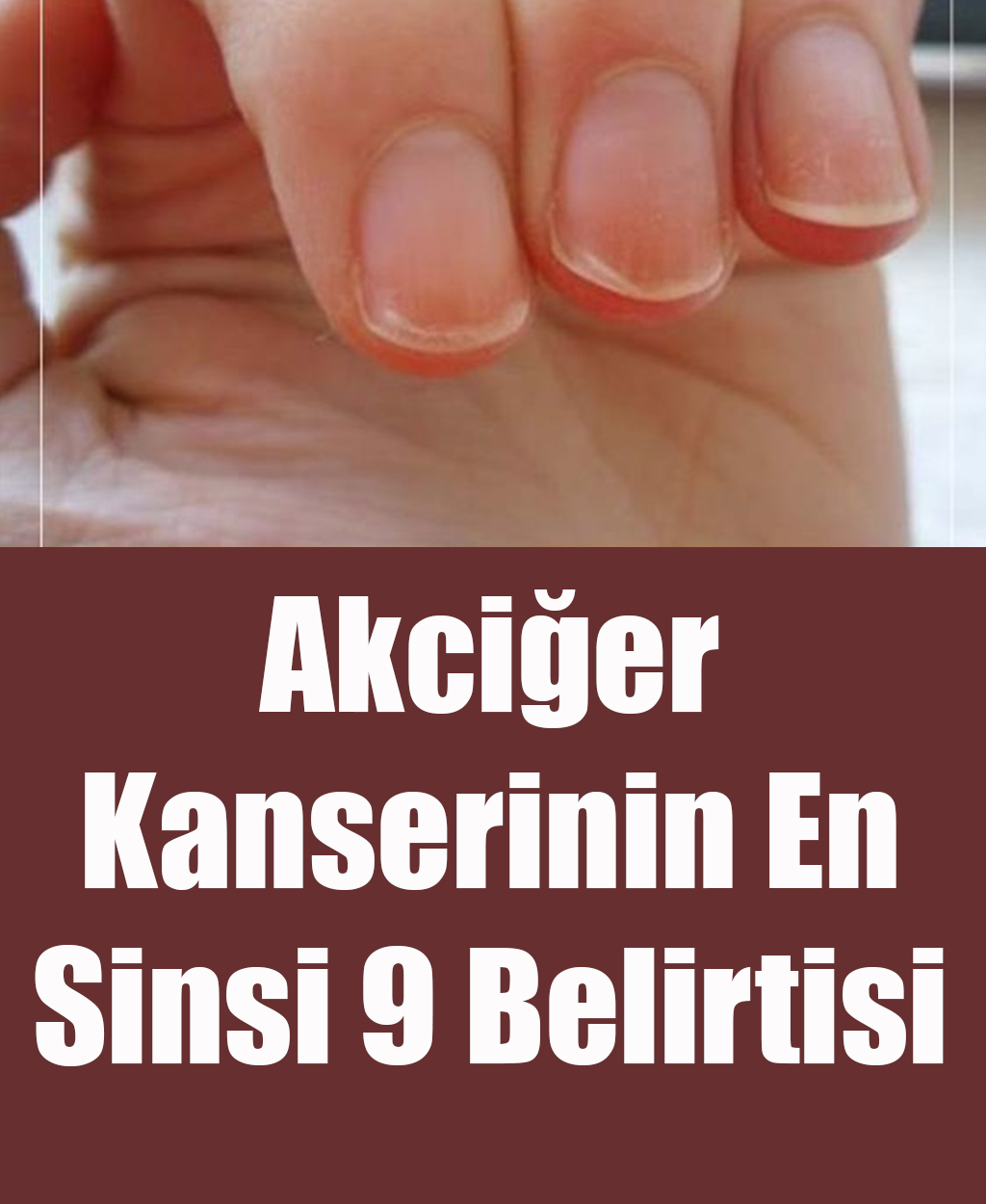 Akciğer Kanserinin En Sinsi 9 Belirtisi - 1