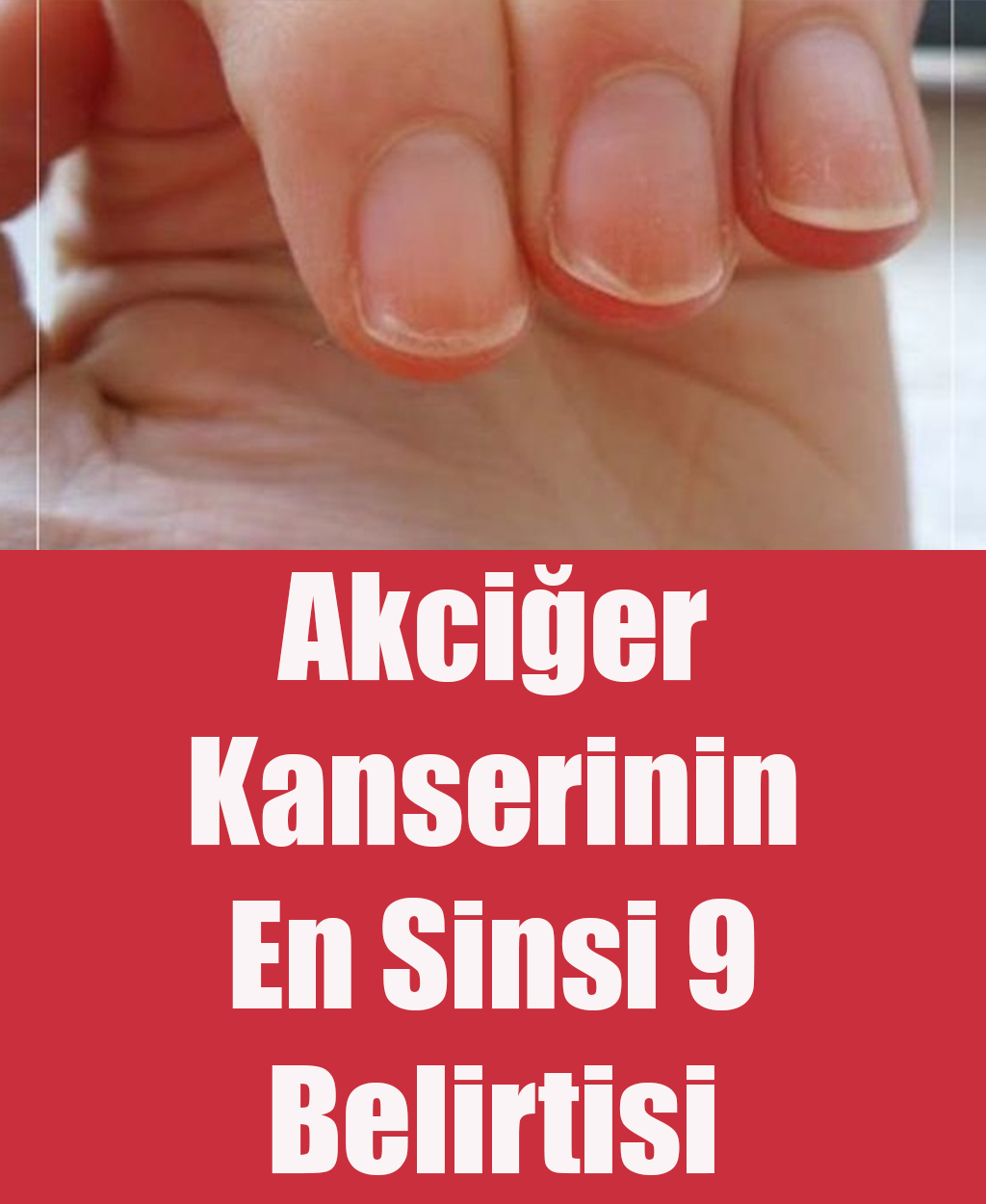 Akciğer Kanserinin En Sinsi 9 Belirtisi - 1