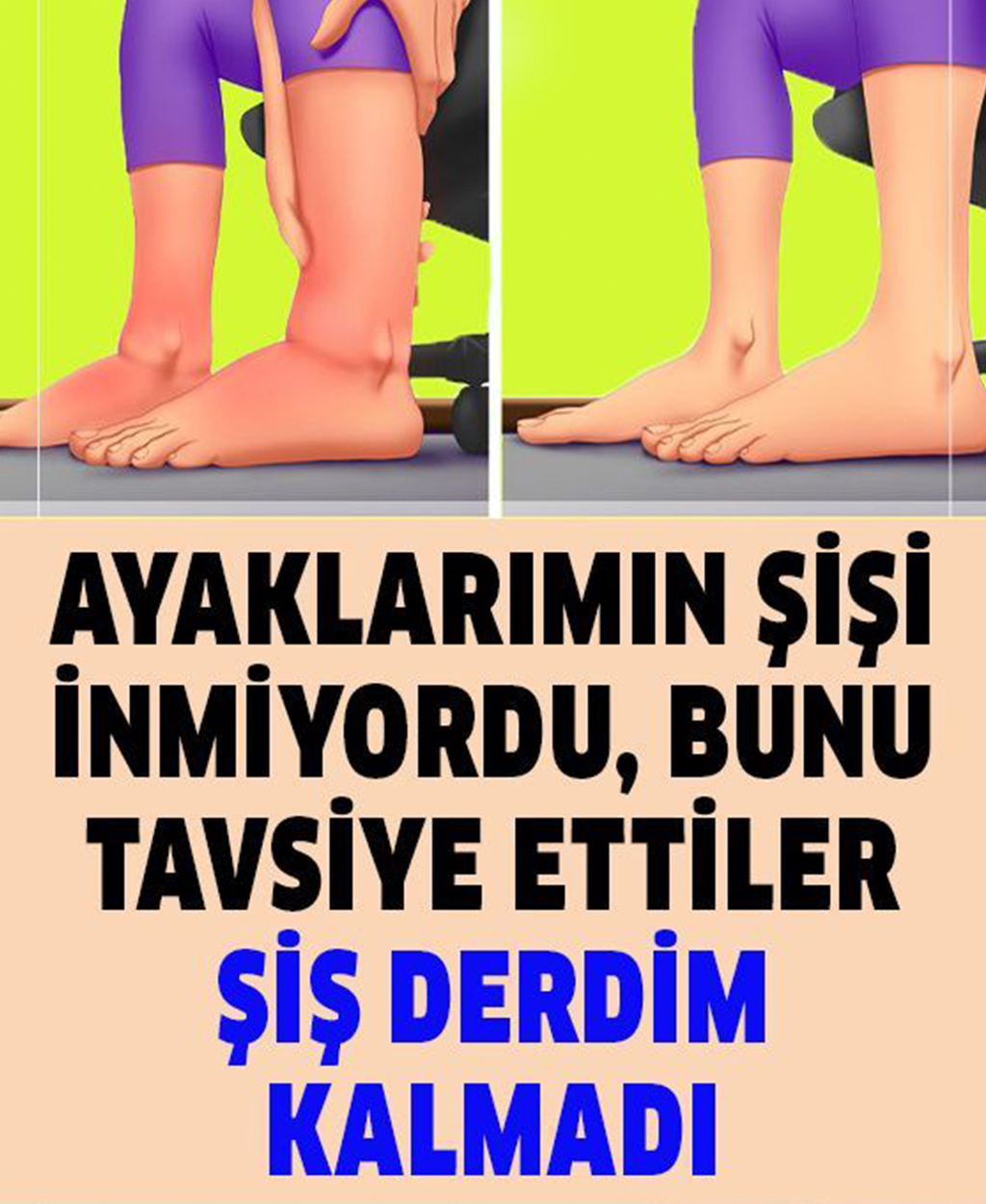 Ayaklarımın Şişi İnmiyordu, Bunu Tavsiye Ettiler - 1