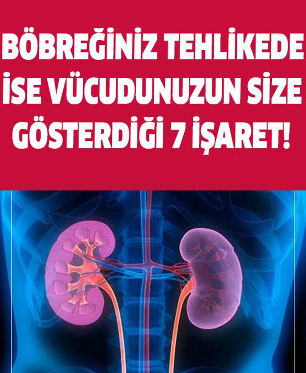 Böbreğiniz tehlikede ise, vücut size bu 7 işareti verecek - 1