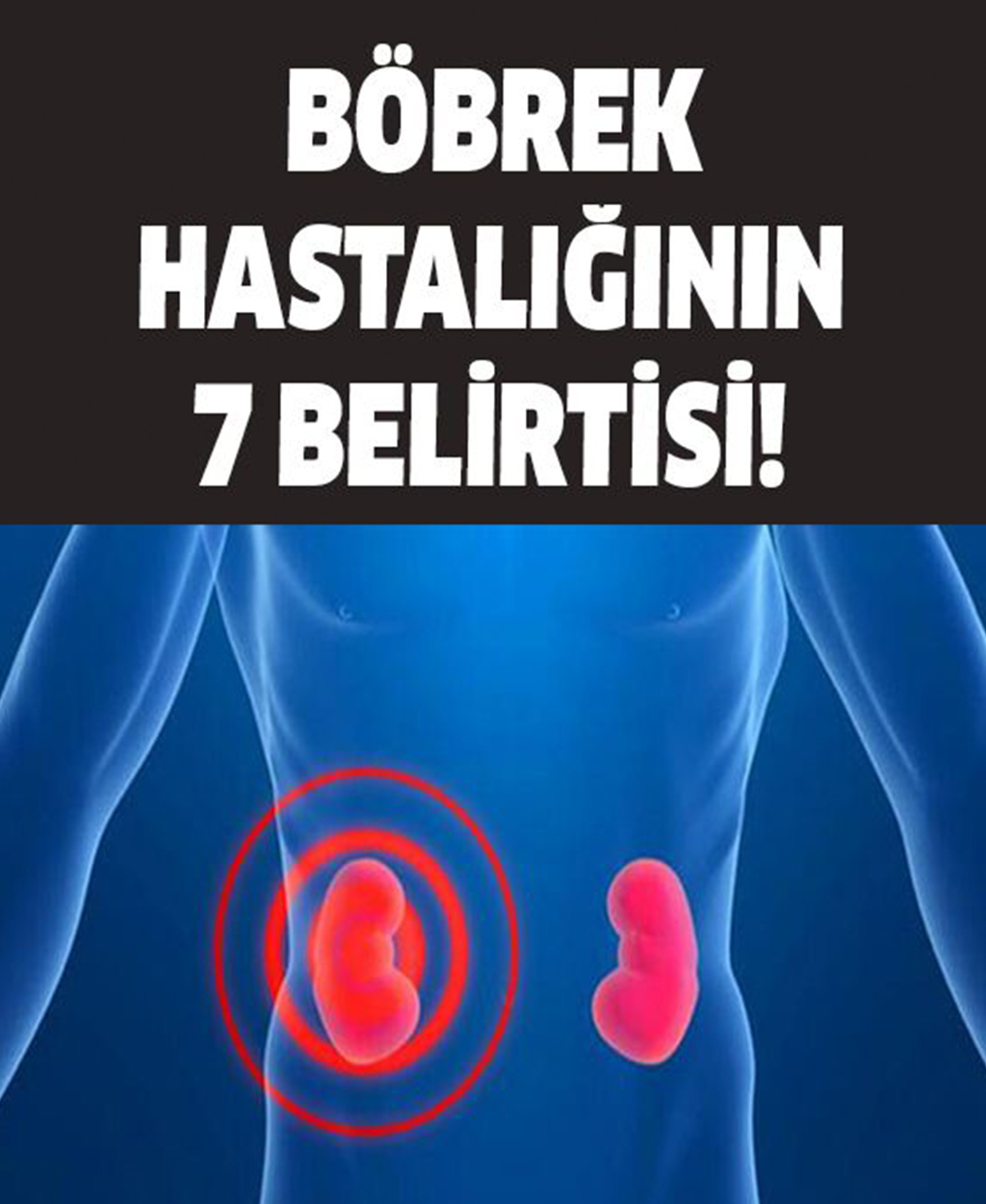 Böbrek Hastalığının 7 Belirtisi - 1