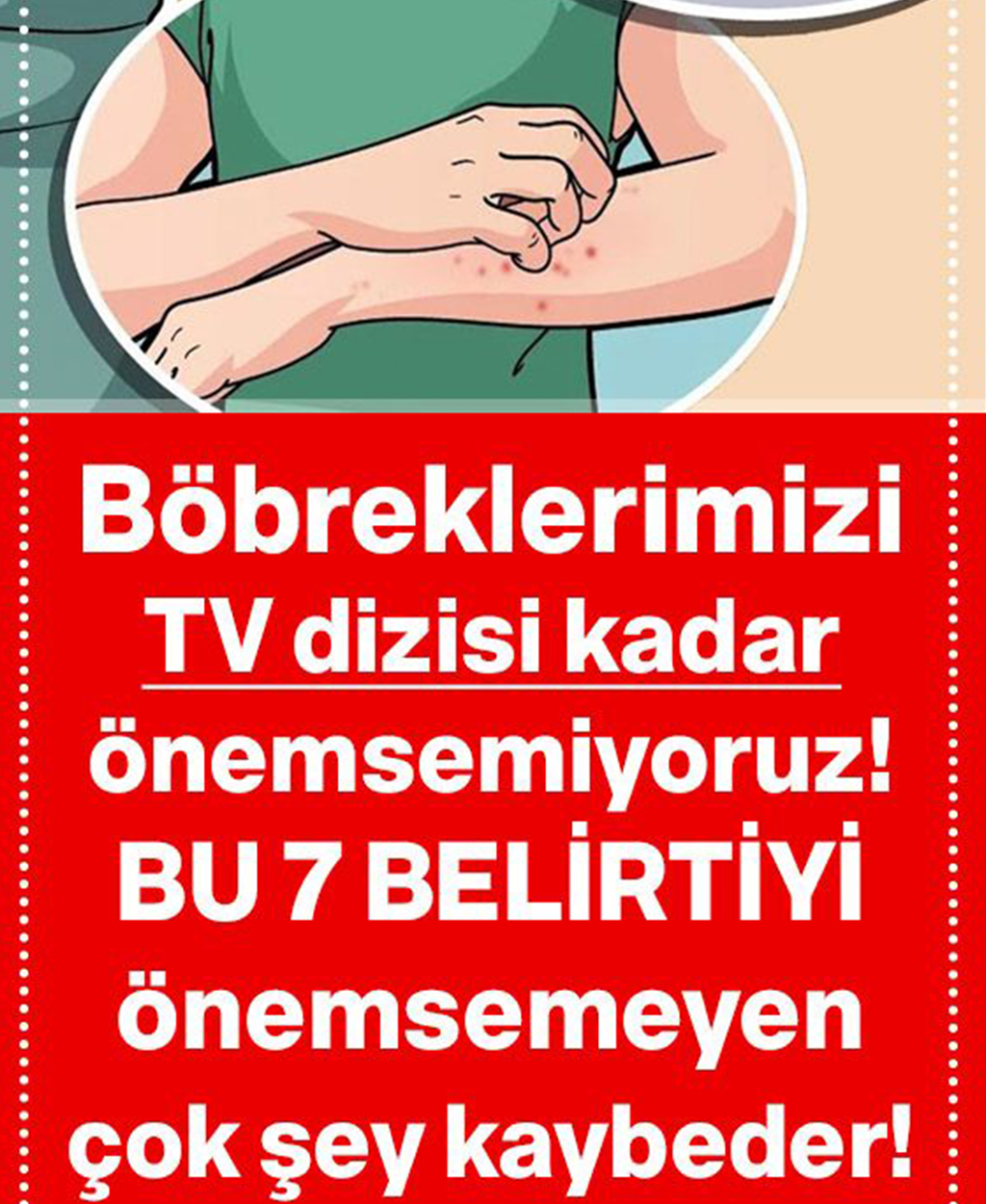 Böbreklerimiz Sağlıklı Olmadığında Bu 7 İşareti Vücudumuza Gönderiyor - 1