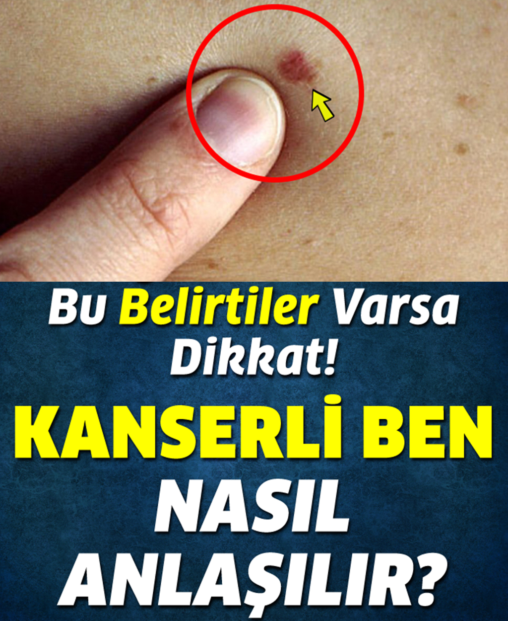 Bu Belirtiler Varsa Dikkat Nasıl Anlaşılır - 1