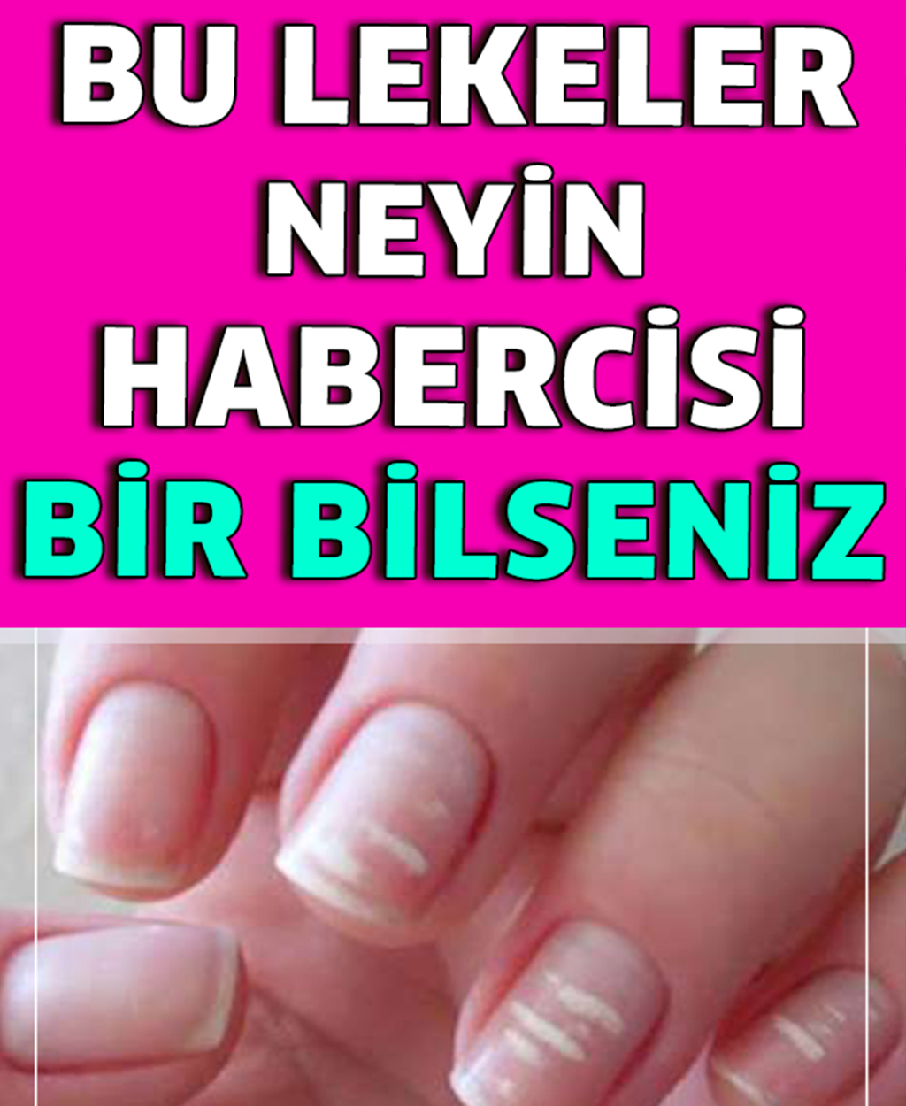 Bu Lekeler Neyin Habercisi - 1