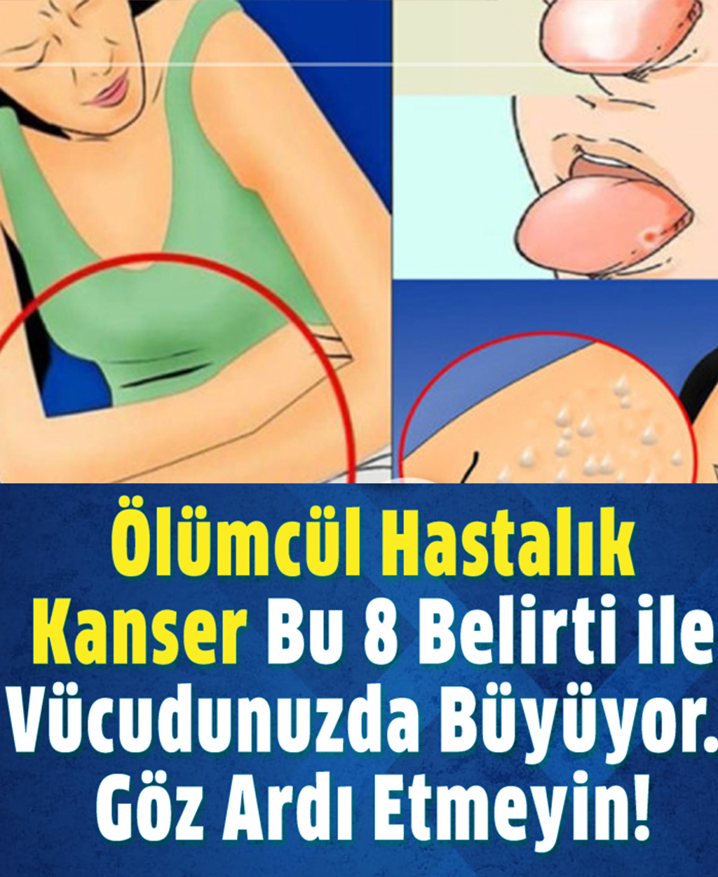 Kanserin Vücuda Verdiği 8 Belirti	 - 1