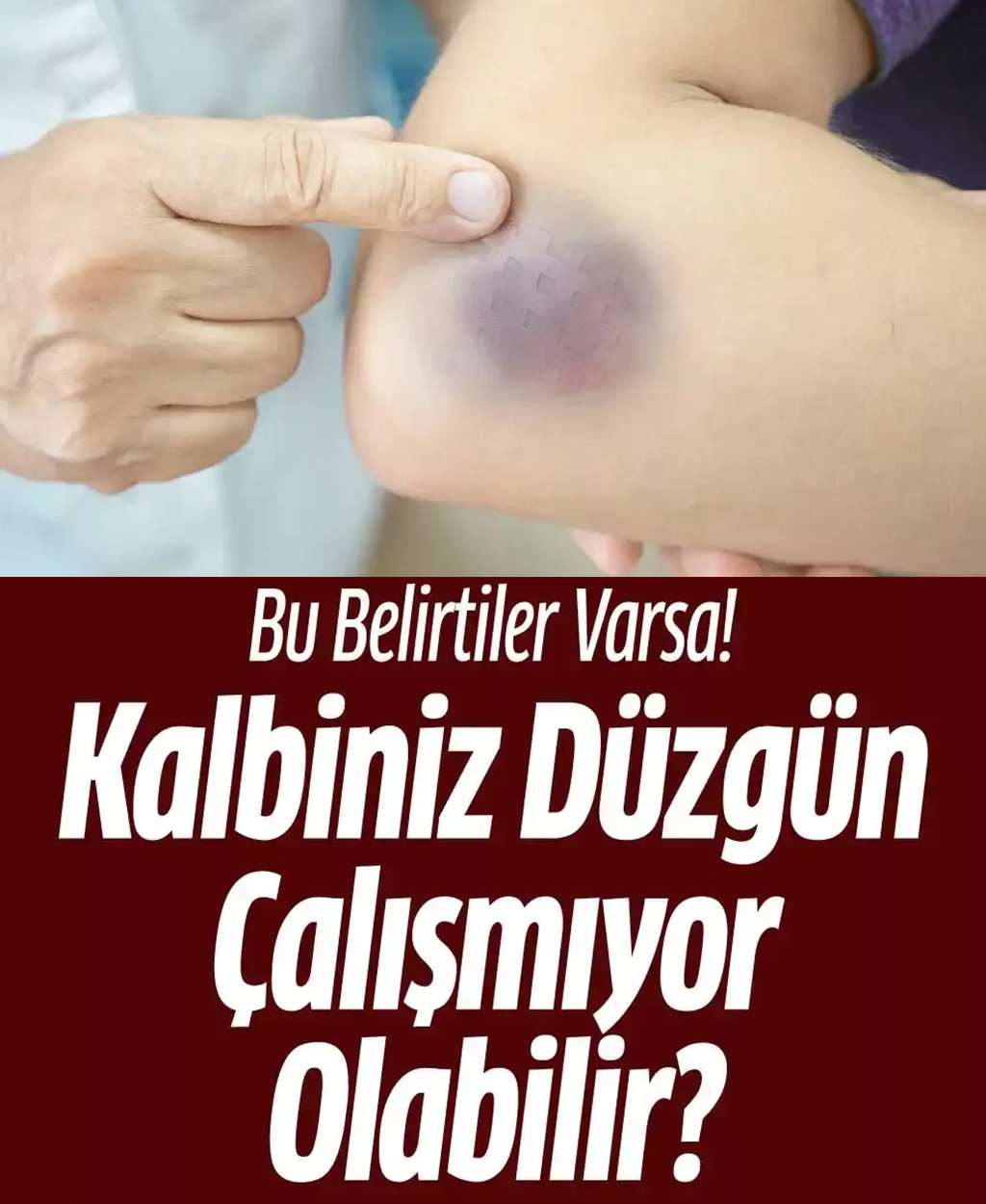 Bu Belirtiler Varsa Kalbiniz Düzgün Çalışmıyor Olabilir - 1