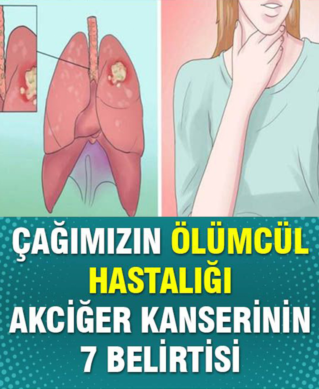 Çağın Hastalığı Akciğer Kanserinin 7 Belirtisi - 1