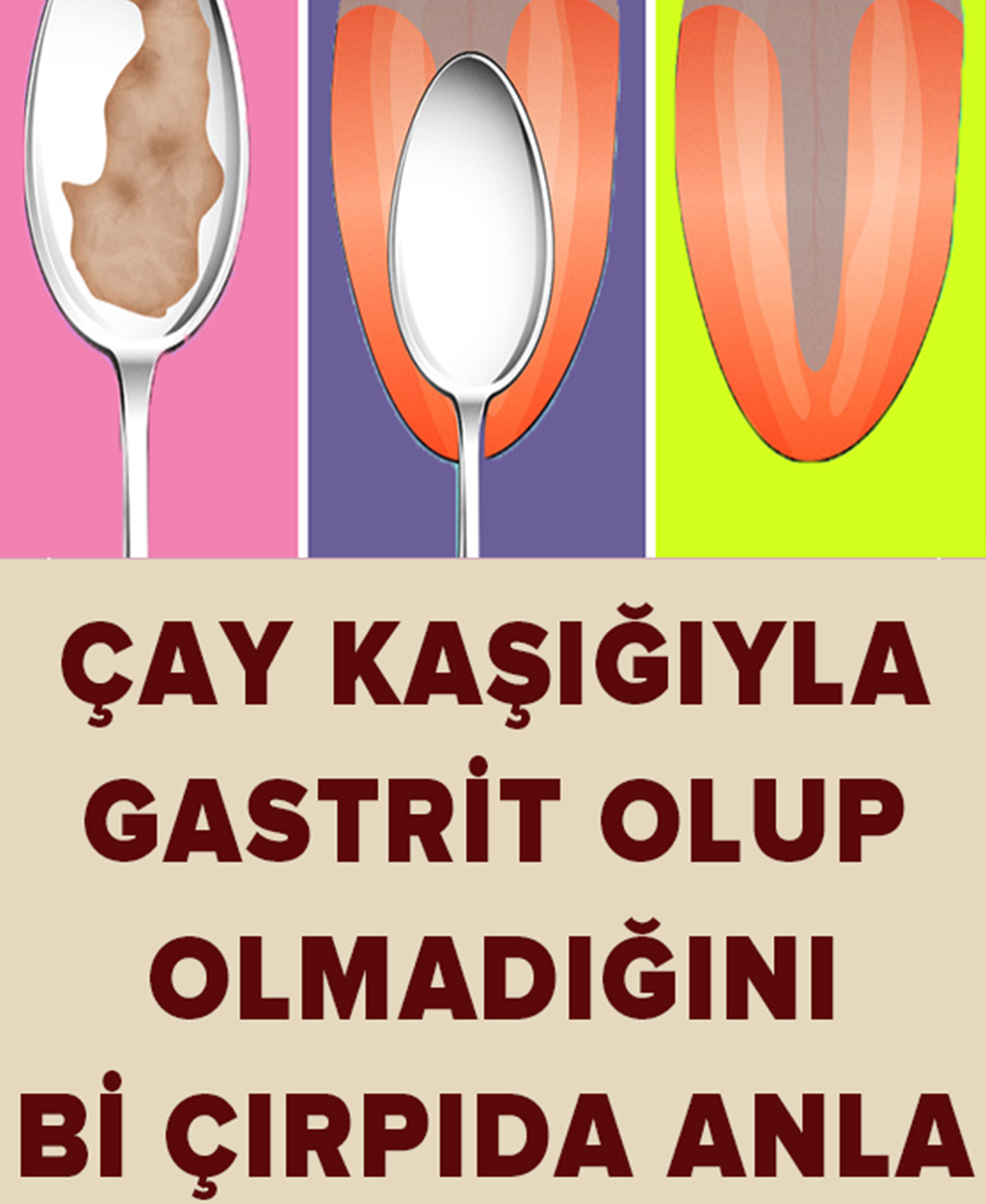 Gastrit Olup Olmadığınızı Anlayın - 1