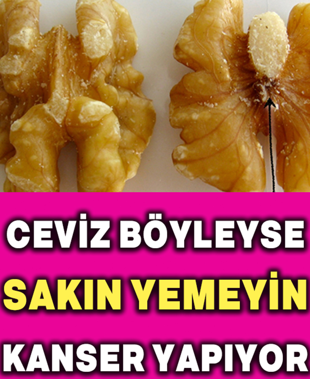 Ceviz Böyle İse Sakın Yemeyin - 1