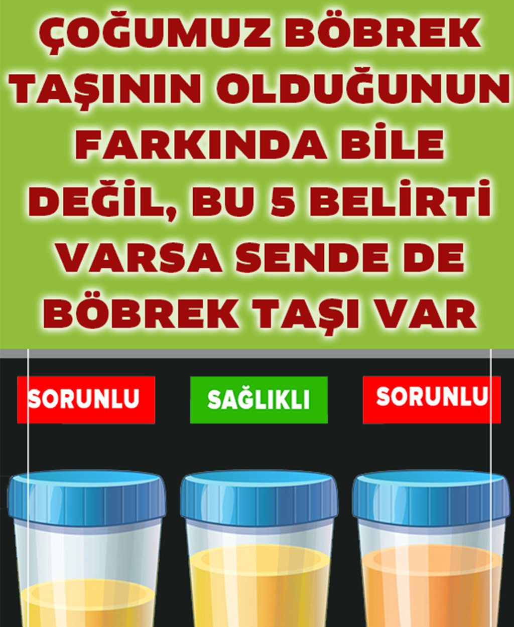 Eğer Bu 5 Belirti Varsa Böbrek Taşınız Olabilir - 1