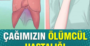 Çağın Hastalığı Akciğer Kanserinin 7 Belirtisi