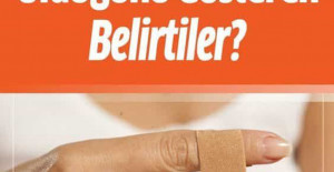 D Vitaminin Eksikliğini Gösteren Belirtiler