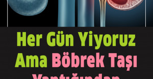 HerGün Yiyoruz Ama Böbrek Taşı Yaptığından Kimsenin Haberi Yok