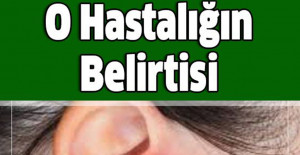 Kadınlarda Daha Sık Görülen O Hastalığın Belirtisi