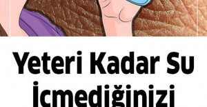 Yeteri kadar su içmediğinizde başınıza bunlar gelir