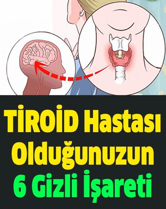 Tiroid Hastası Olduğunuzun 6 Saklı İşareti - 1