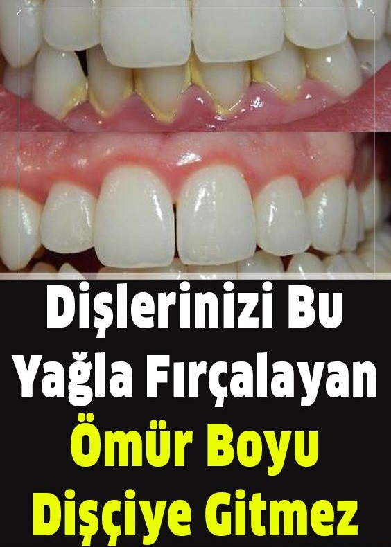 Ömür Boyu Dişçiye Gitmemek İçin Dişlerinizi Bu Yağ ile Fırçalayın - 1