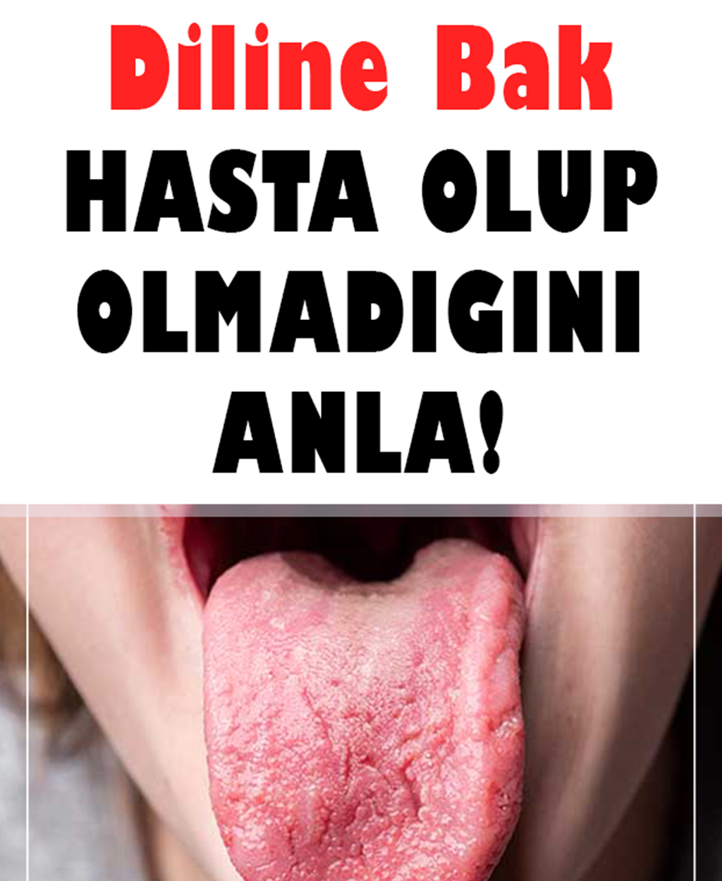 Hasta Olup Olmadığını Diline Bakarak Anla - 1