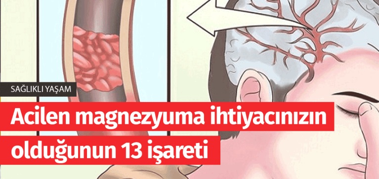 Acilen Magnezyuma Lüzumunuzun Olduğunun 13 İşareti - 2