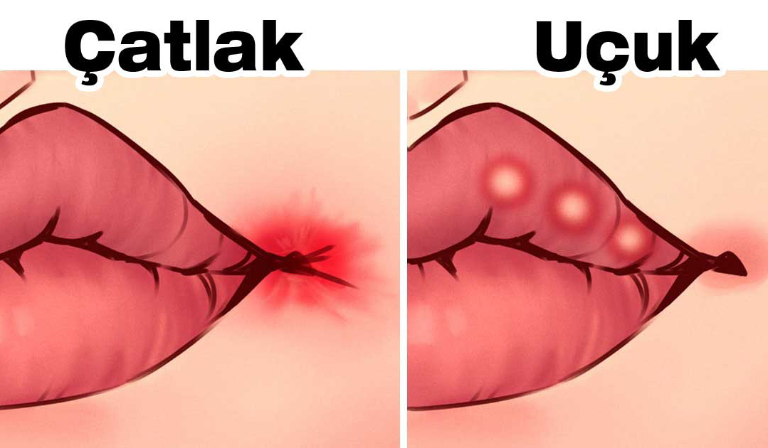 Hepsinin Bir Anlamı Var Hangi Hastalıkların Belirtisi - 2