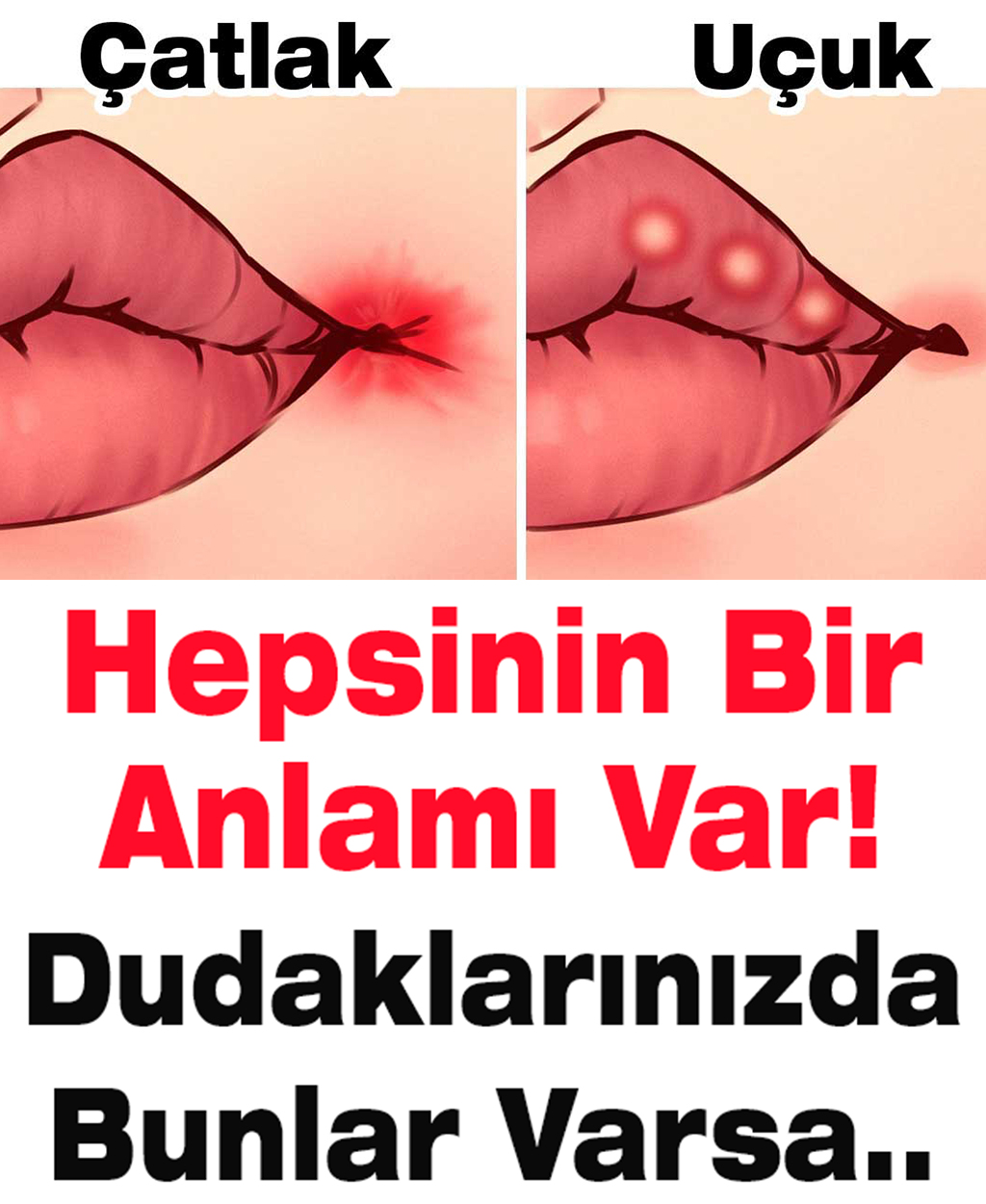 Hepsinin Bir Anlamı Var Hangi Hastalıkların Belirtisi - 1