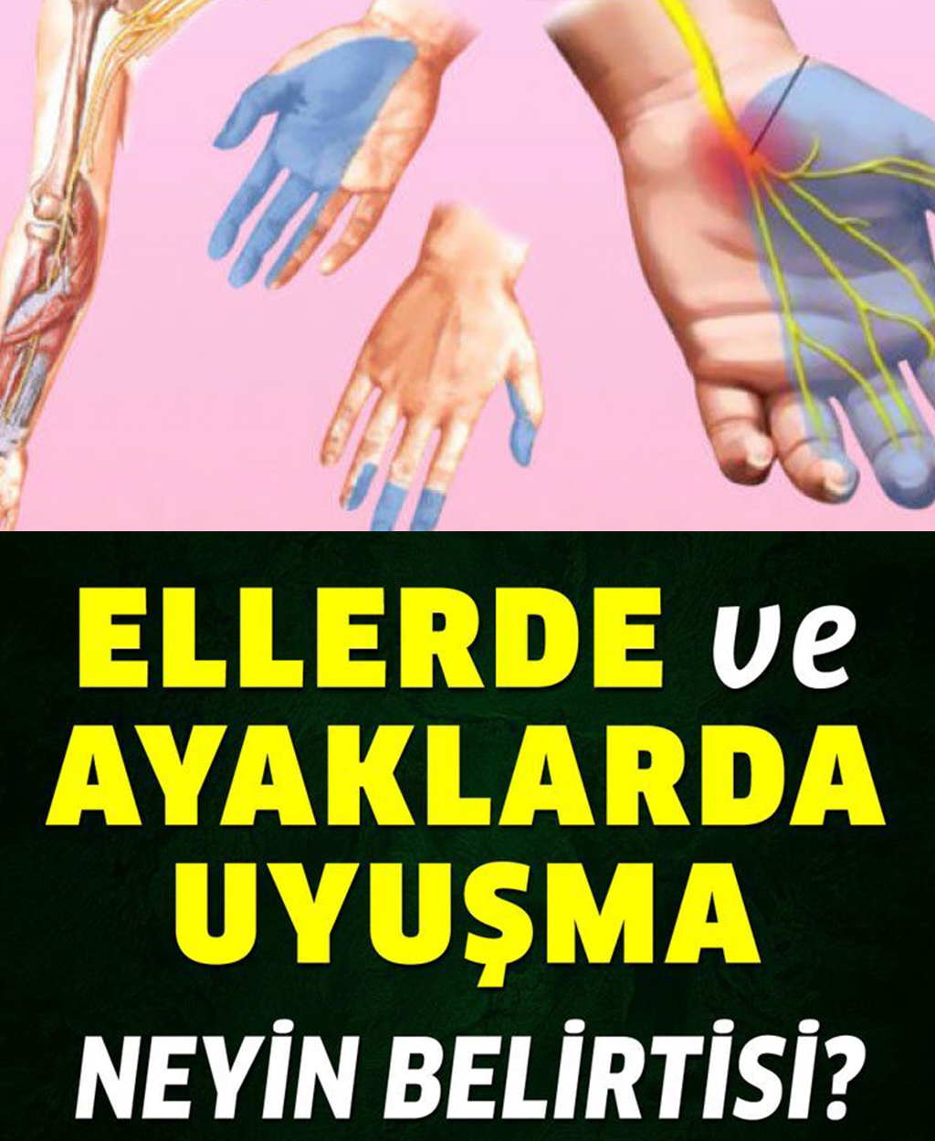 El ve ayak uyuşması neyin belirtisi - 1