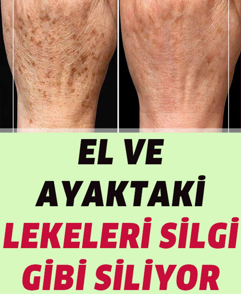 El ve Ayaktaki Lekeleri Silgi Gibi Siliyor - 1