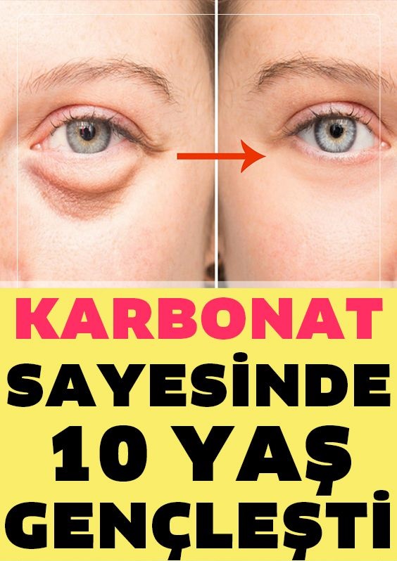 Karbonat İle 10 Yaş Genç Görünün - 1