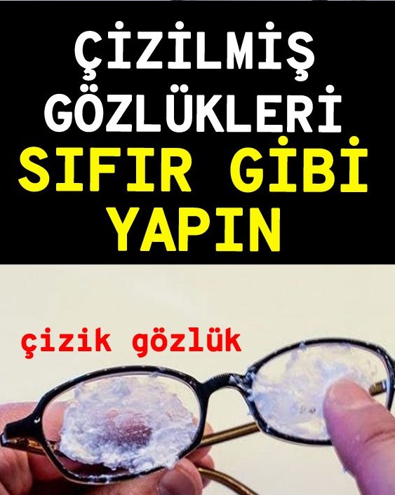 Gözlüklerin Çizilmesine Artık Son Veren Pratik Bilgi - 1