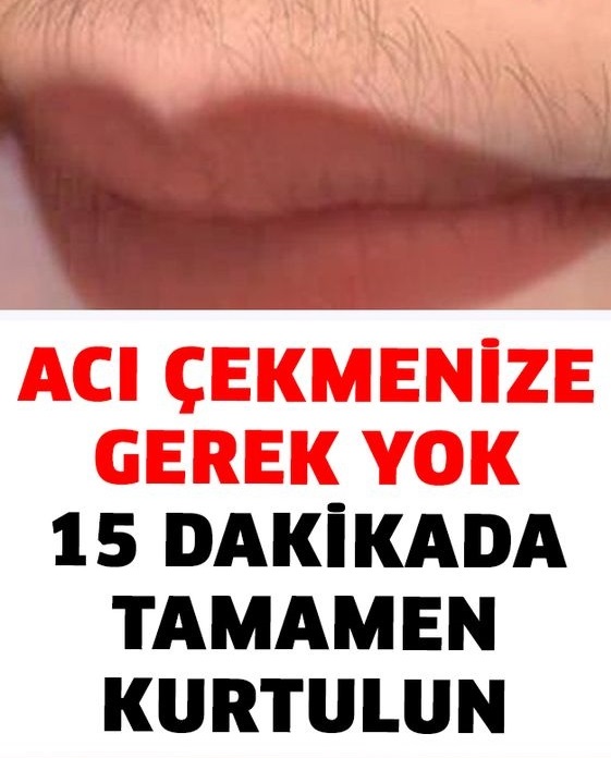 İstenmeyen Tüylerden 15 dakikada Tamamen Kurtulun - 1