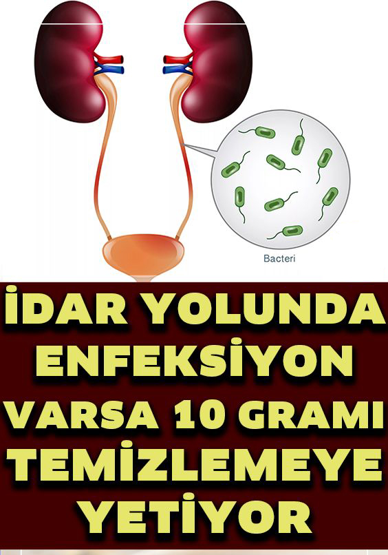 İdrar Yolu Enfeksiyonunu Geçiren 7 Doğal Yöntem - 1