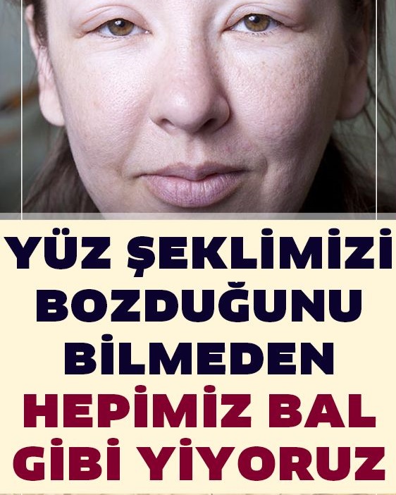 Yüz Şeklimizi Bozduğunu Bilmeden Hepimiz Bal Gibi Yiyoruz - 1