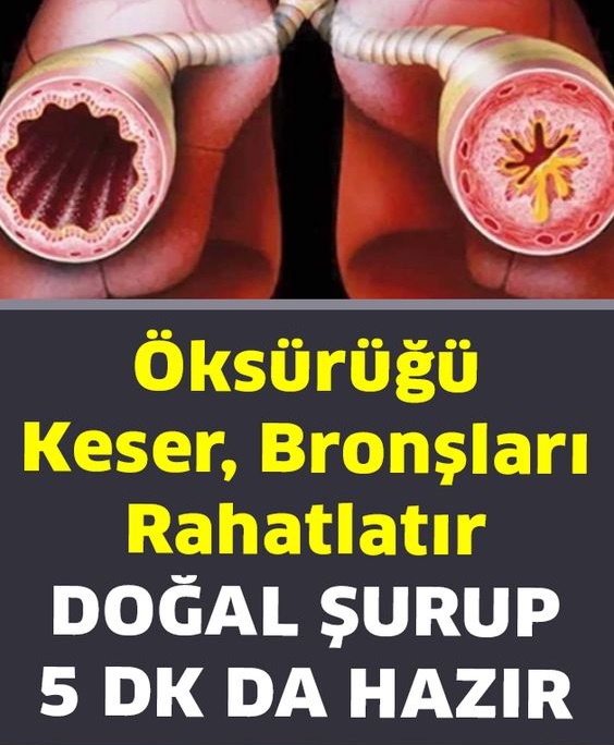 Öksürüğü Keser, Bronşları Rahatlatır Doğal Öksürük Şurubu Tarifi - 1