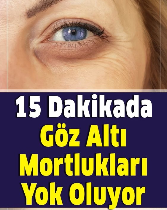 15 Dakikada Göz Altı Morluklarını Yok Ediyor - 1