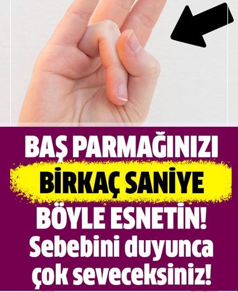 Başparmağınızla yüzük parmağınızı birkaç saniyeliğine böyle esnetin - 1