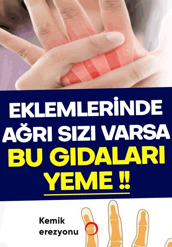 Eklemlerinde ağrı olan var bu gıdaları tüketmesin - 1