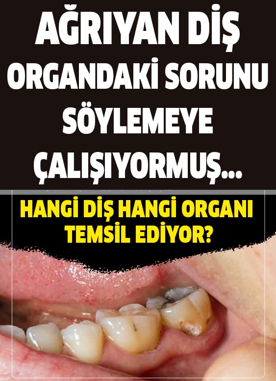 Ağız içindeki dişleriniz belirli organ ve sistemlere karşılık gelir - 1