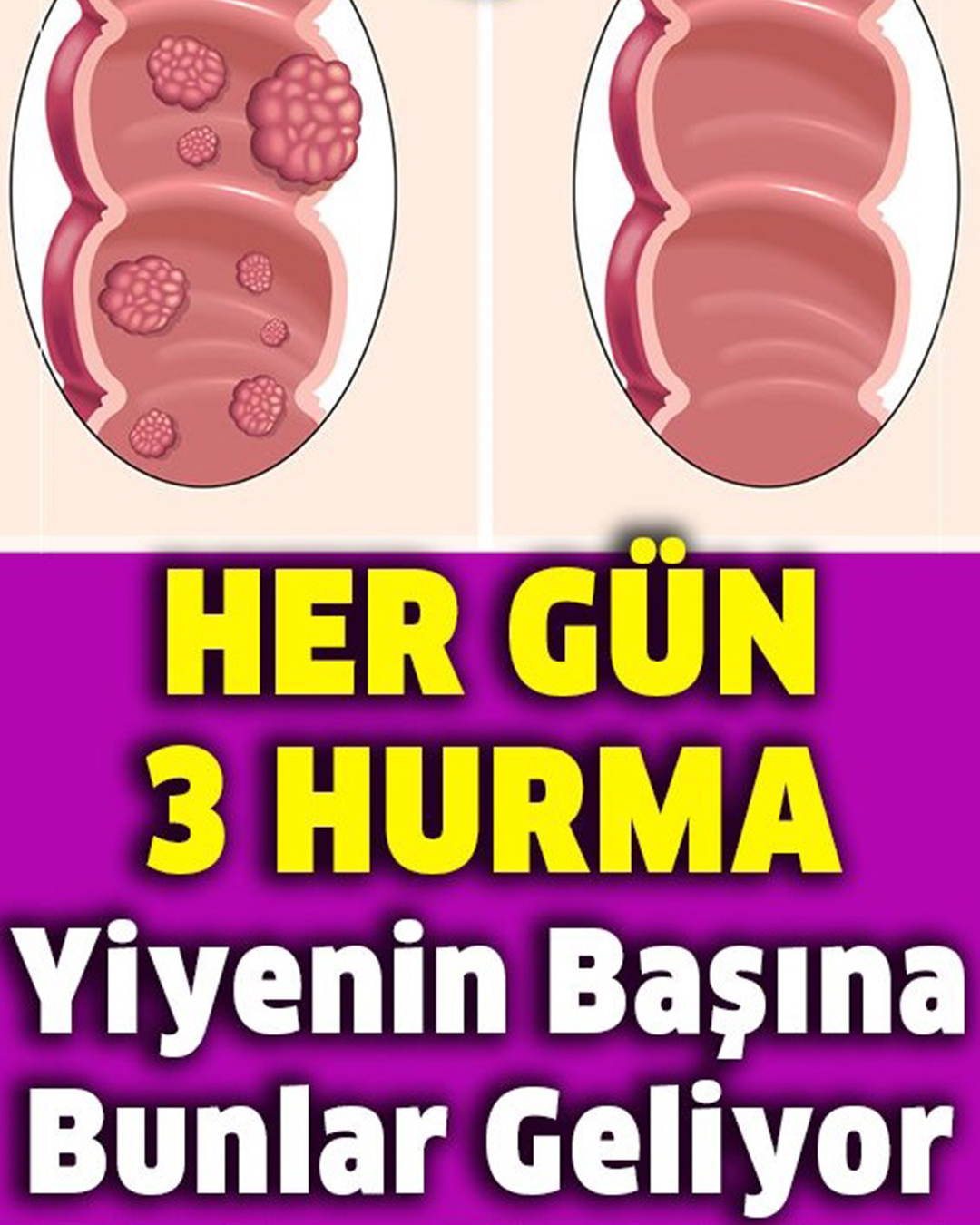 Her Gün 3 Hurma Yiyenin Başına Bunlar Geliyor - 1