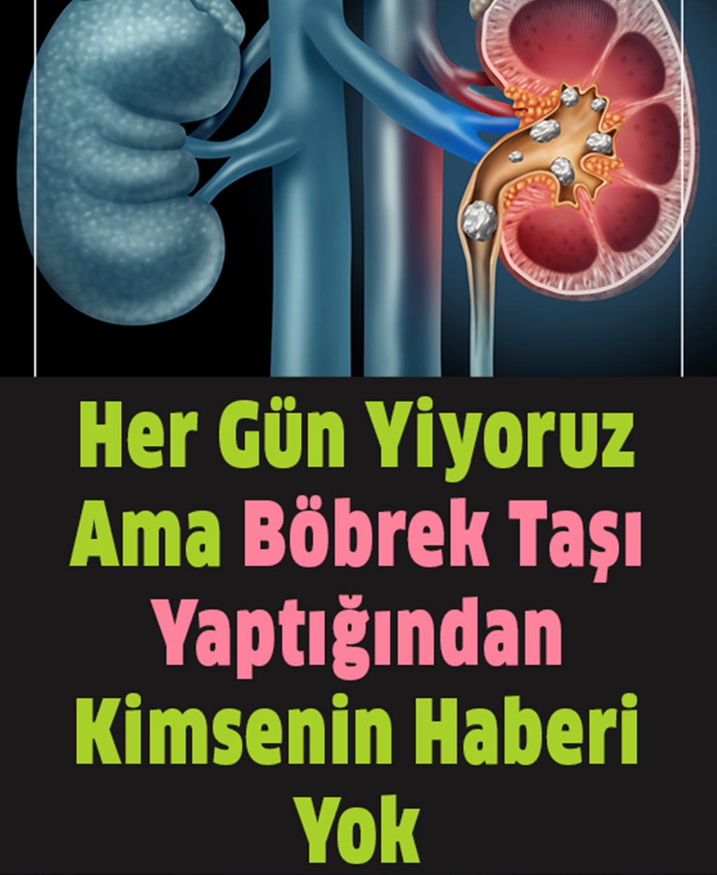 Her Gün Yiyoruz Ama Böbrek Taşı Yaptığından Kimsenin Haberi Yok - 1