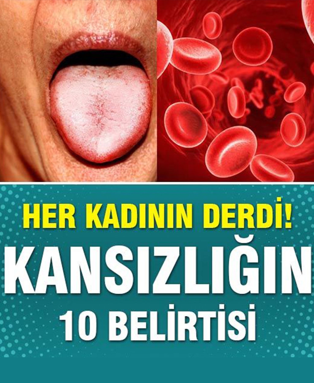 Her Kadının Derdi Kansızlığın 10 Belirtisi - 1