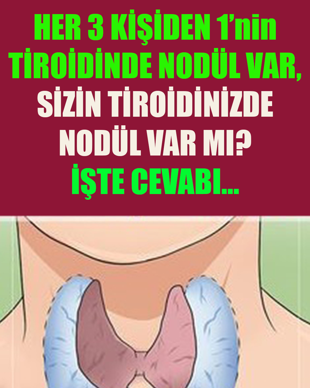 Her 3 Şahıstan Birinin Tiroidinde Nodül var, Peki Ya Sizde ? - 1