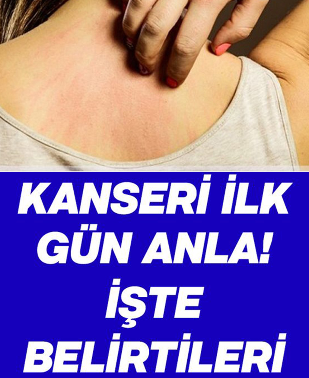 Kanser olduğunuzu nasıl anlarsınız işte belirtileri - 1