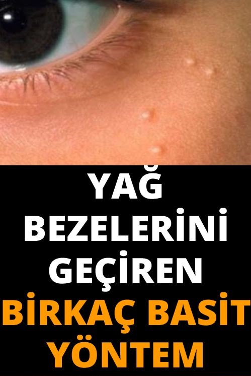 Yağ Bezelerini Geçirmenin En Etkili Yolları - 1