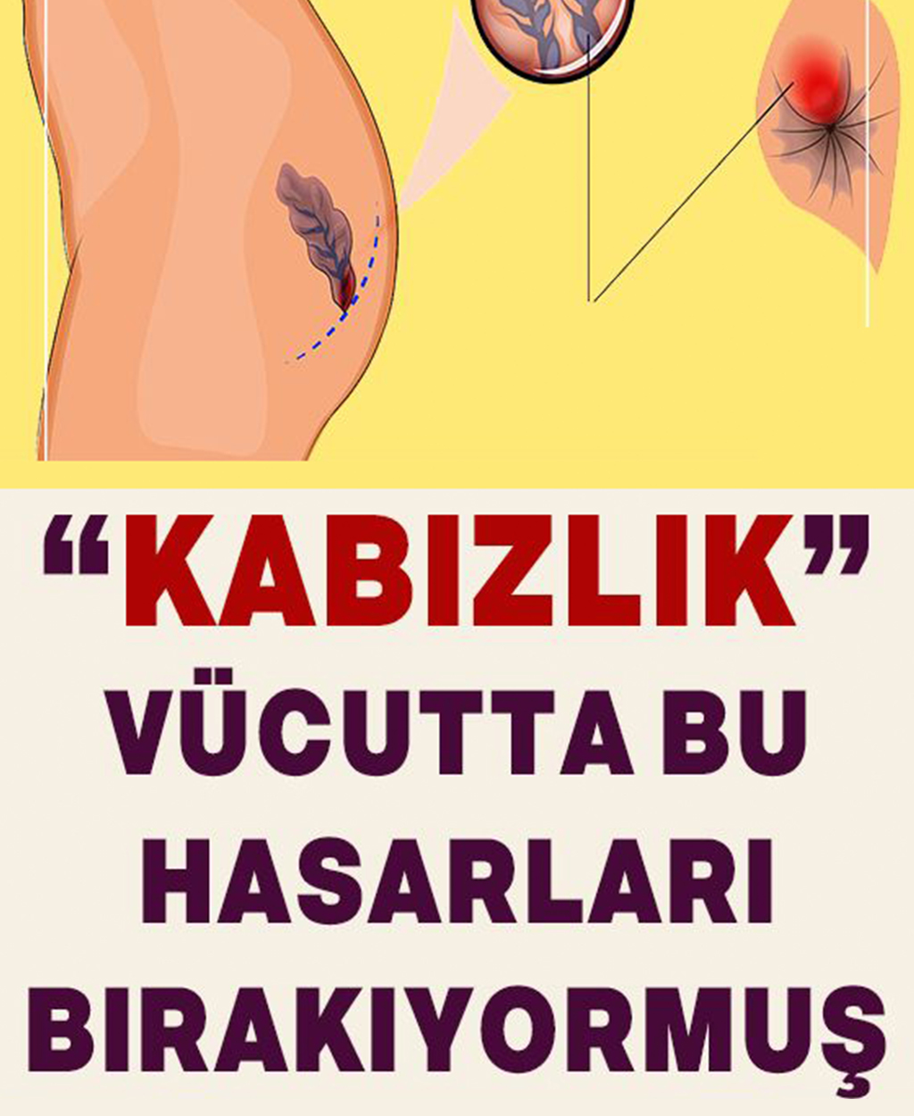 Kabızlık vücutta bu hasarları bırakıyormuş - 1