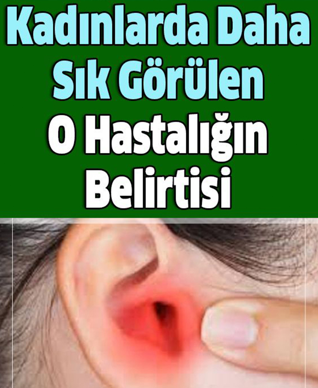 Kadınlarda Daha Sık Görülen O Hastalığın Belirtisi - 1