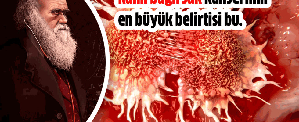 Kalın Bağırsak Kanserinin En Büyük Bulgusu - 2