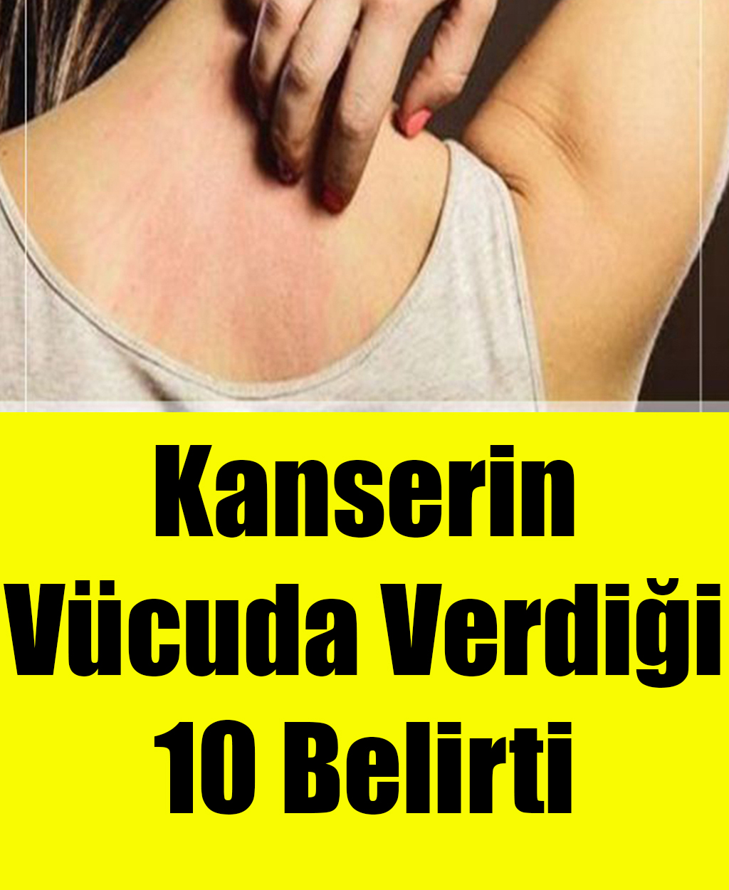 Kanserin Vücuda Verdiği 10 Belirti - 1