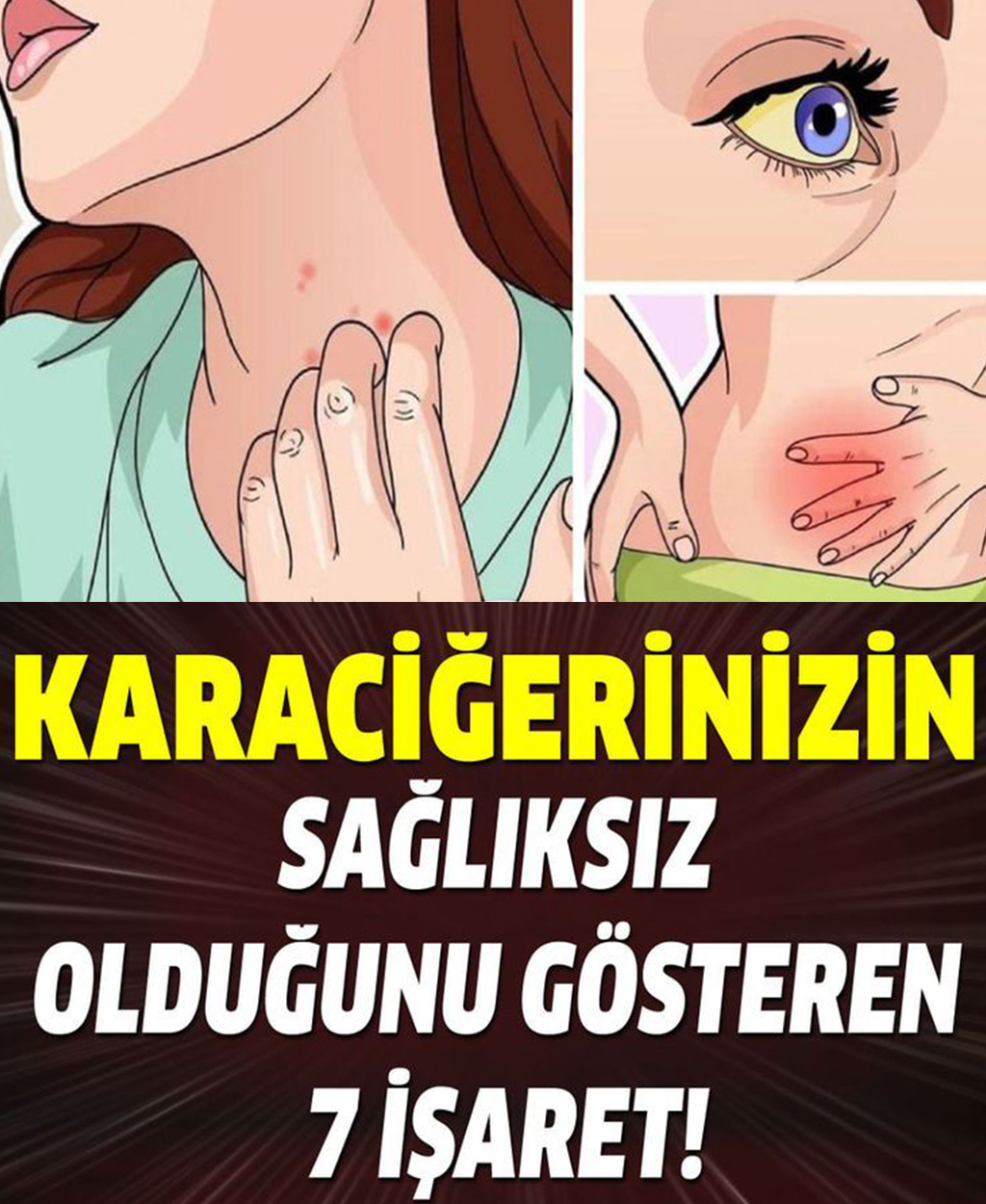 Karaciğerinizin sağlıksız olduğunu gösteren 7 işaret - 1